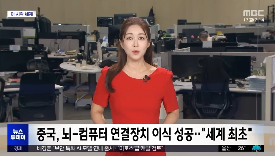 컴퓨터 연결장치 뇌 이식 성공_1.webp