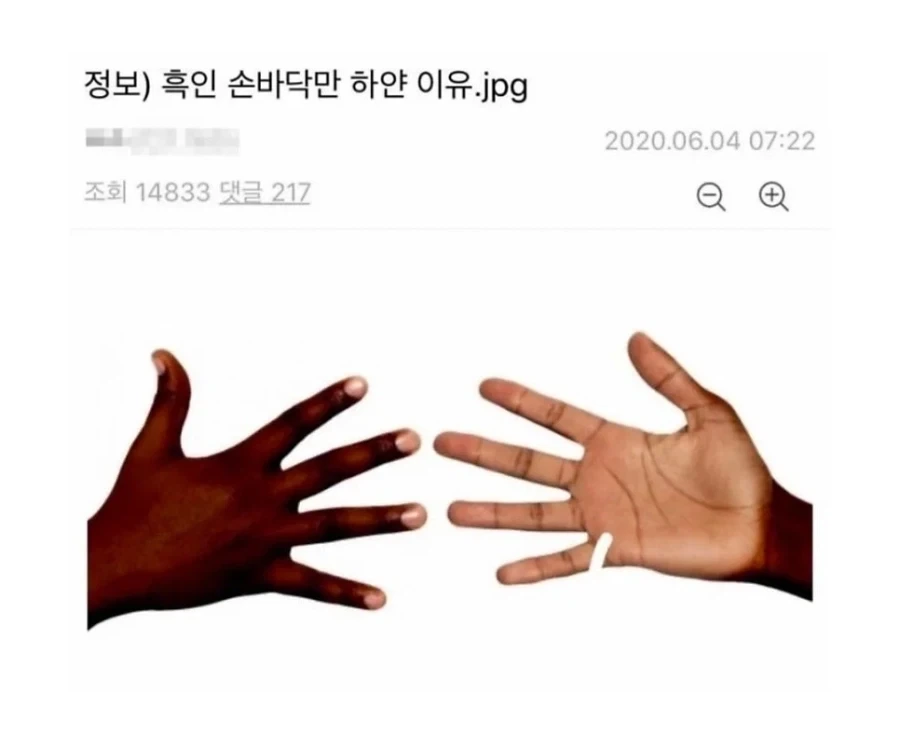 흑인 손바닥만 하얀 이유_1.webp