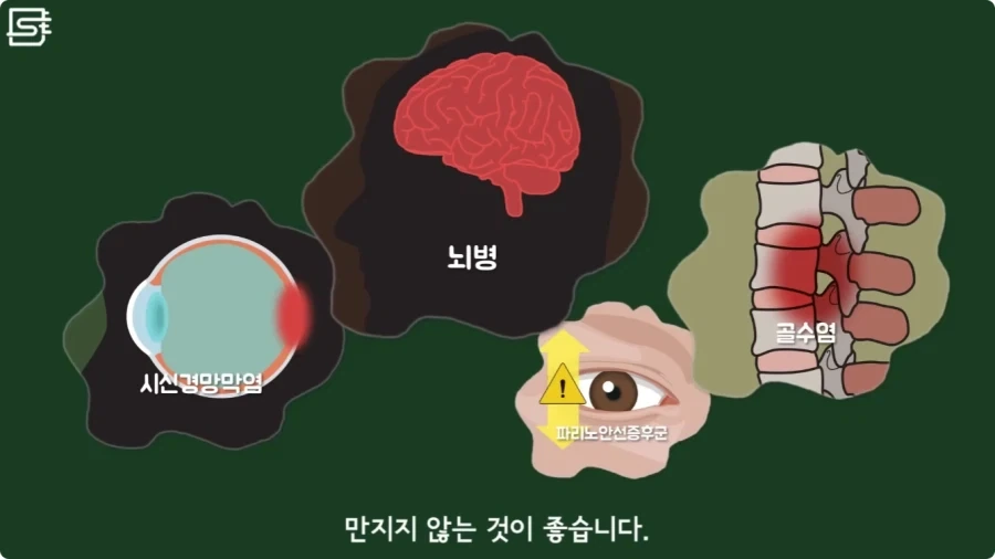 길고양이를 만지면 안되는 이유.jpg_30.webp