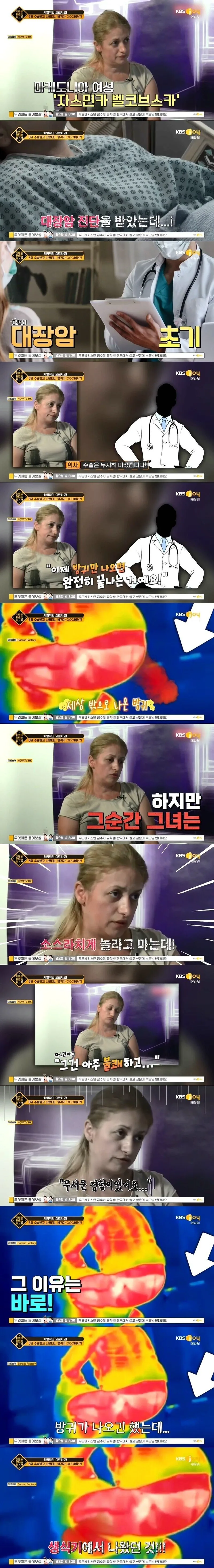 18a322f18c74fa2e4.jpg 대장암 수술했더니 방귀가 생식기에서 나오는 여자.jpg