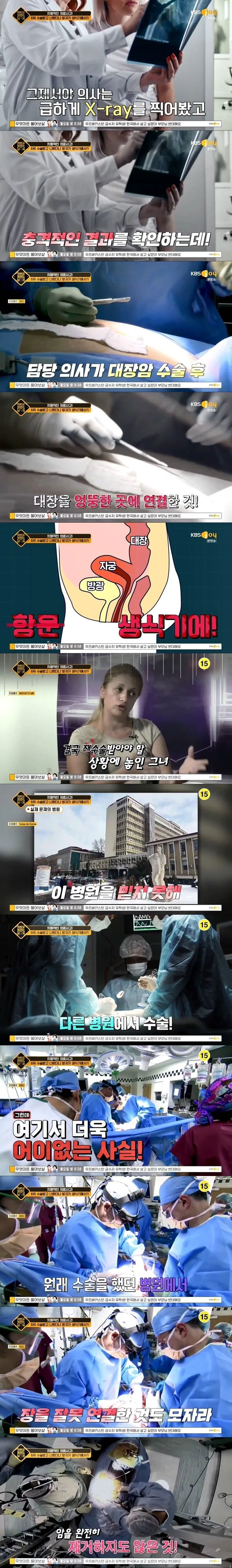 18a322f1c6e4fa2e4.jpg 대장암 수술했더니 방귀가 생식기에서 나오는 여자.jpg