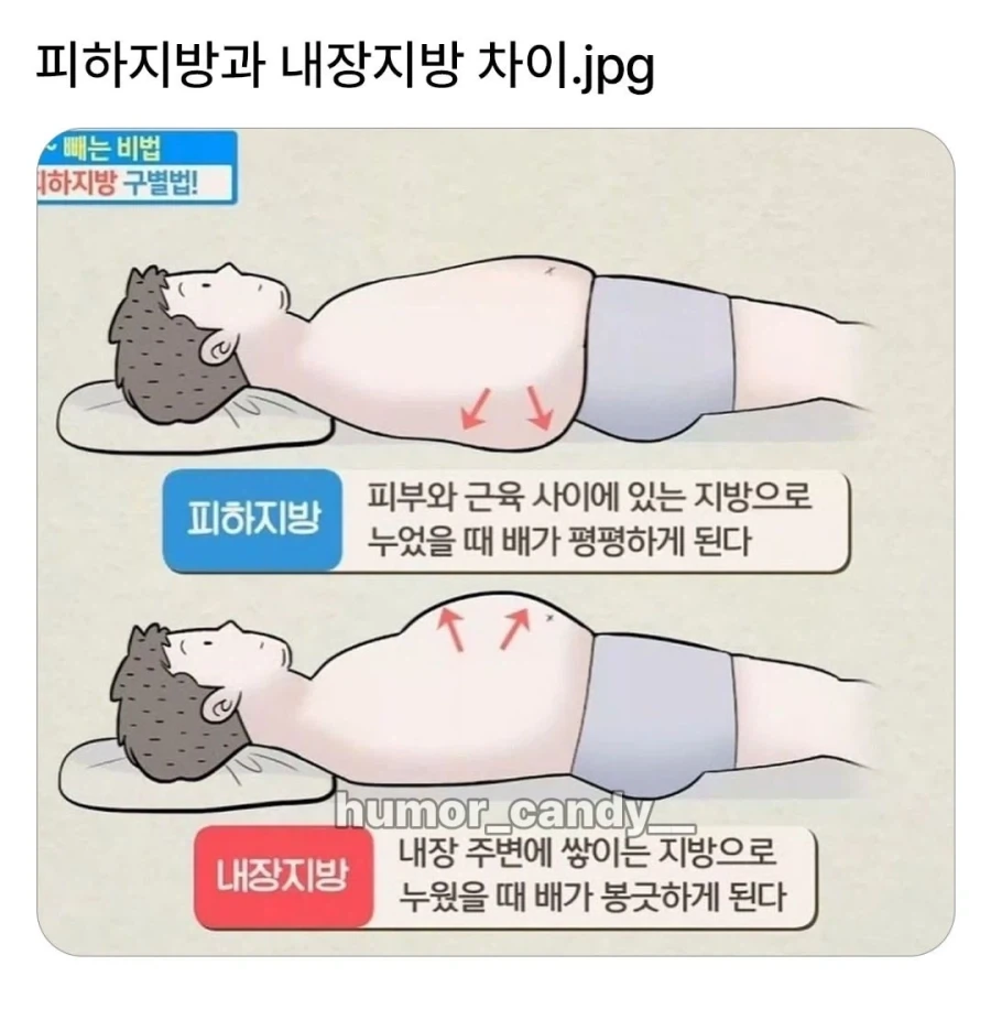 피하지방과 내장지방의 차이.jpg_1.webp