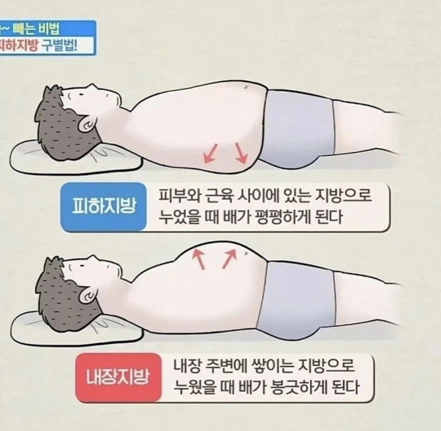 피하지방과 내장지방의 차이_1.webp