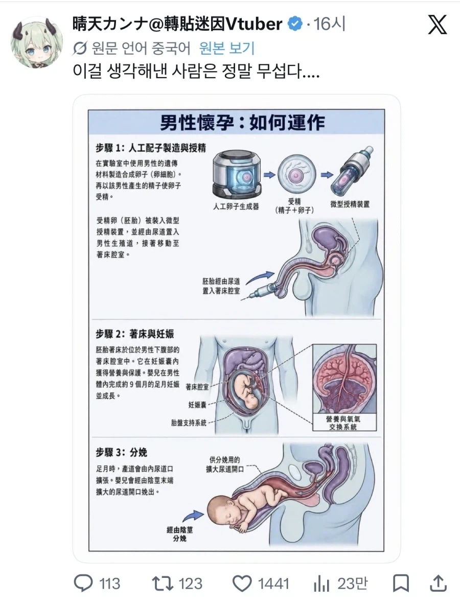 남성도 출산 가능하다_1.webp