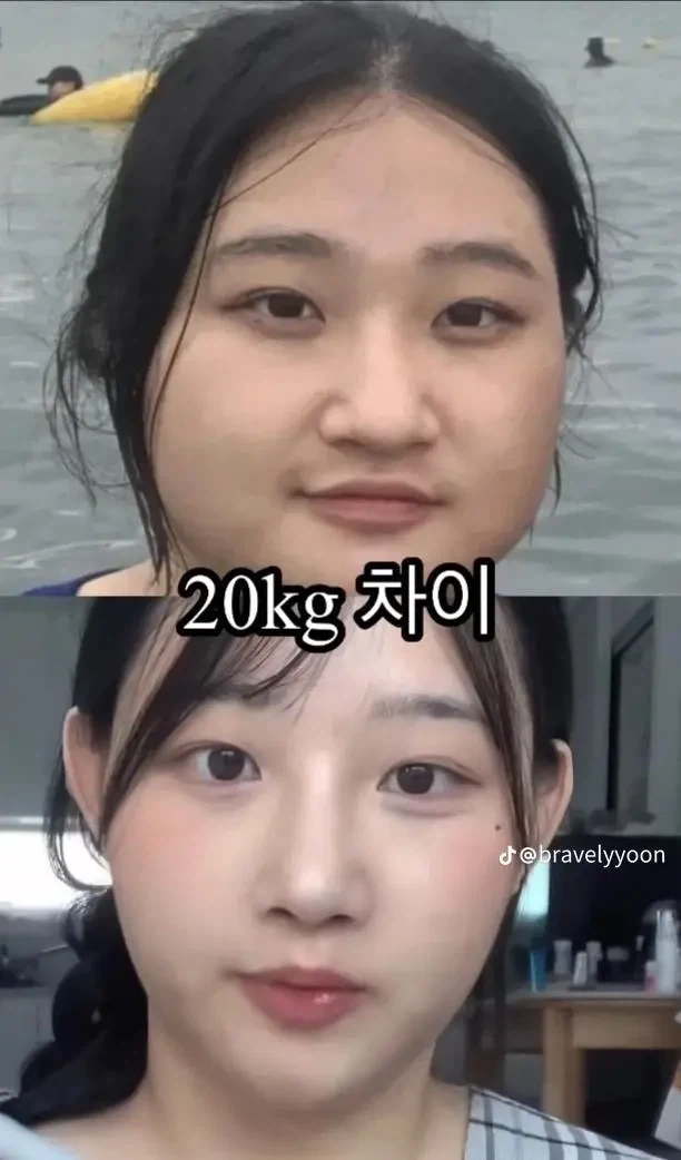 20kg 차이_1.webp