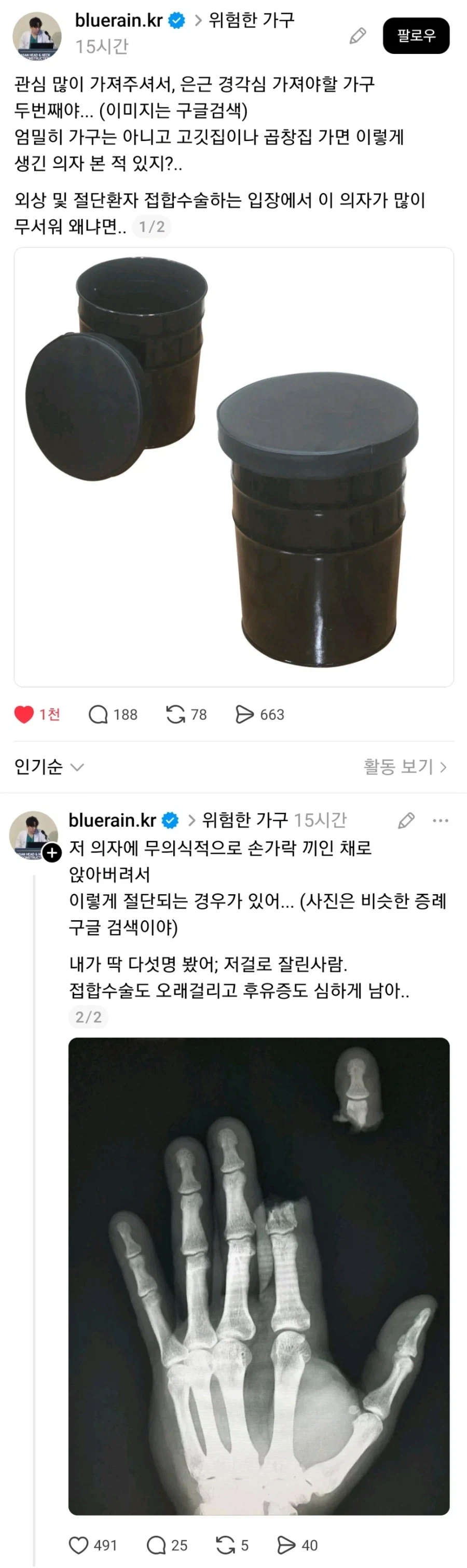 식당에서 밥먹으려다가 손이 절단되는 사례_1.webp