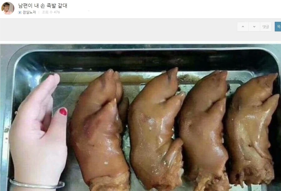 남편이, 내손이 족발 같데.._1.webp