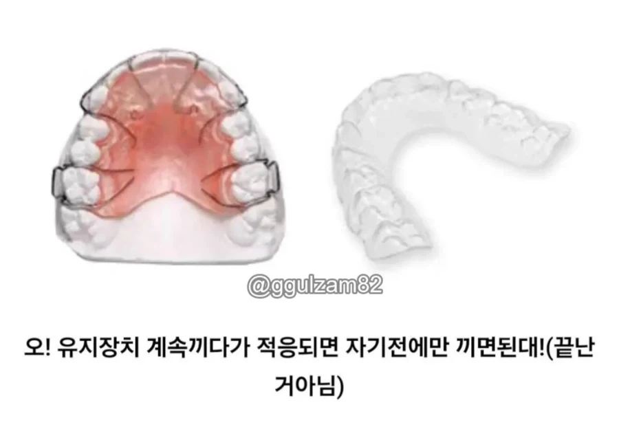 교정 안한 사람들은 모른다는 치아 교정인의 인생.jpg_2.webp