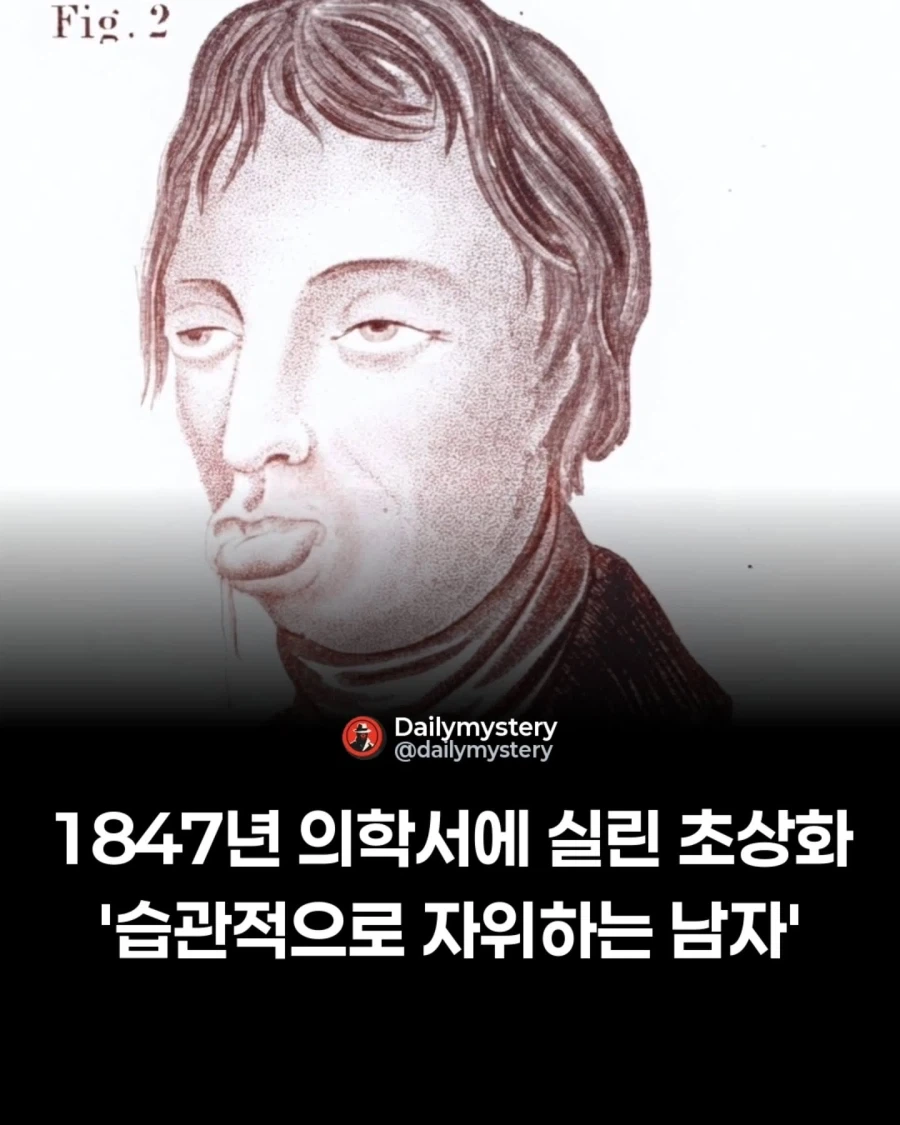 1847년 의학서에 실린 초상화_1.webp