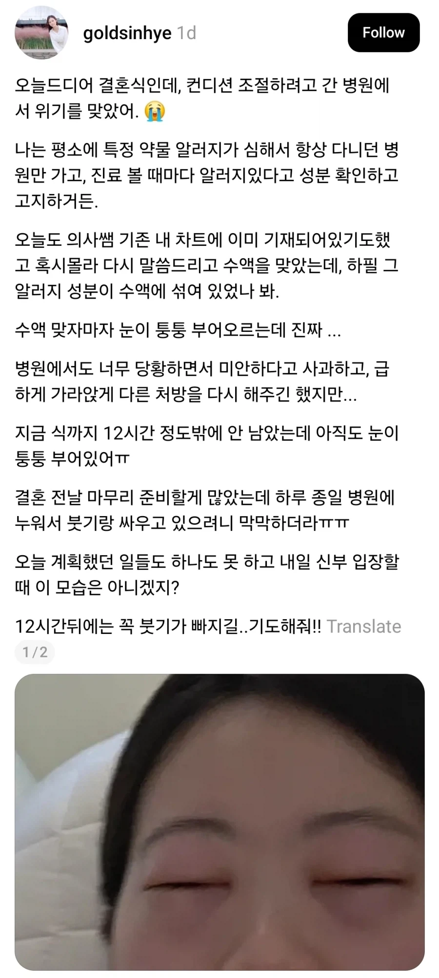 결혼식 전 의료사고 당한 신부_1.webp
