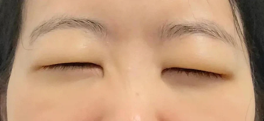 결혼식 전 의료사고 당한 신부_3.webp