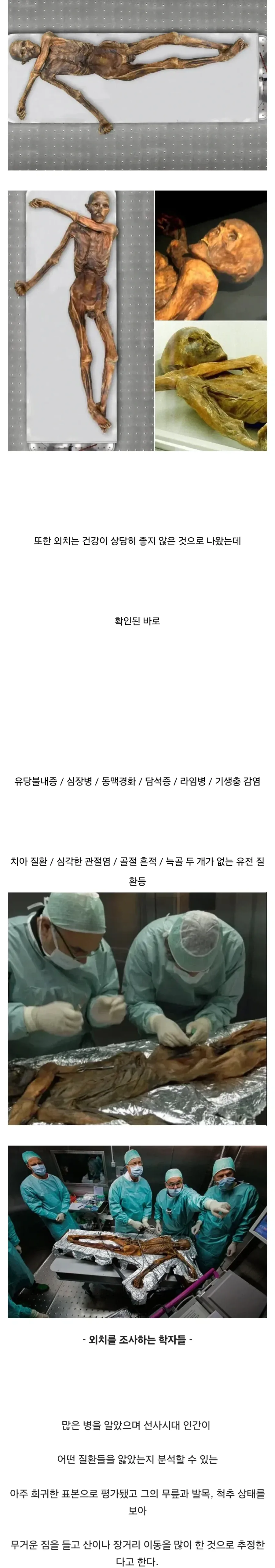 얼음속에서 발견된 5천년전 미라.webp_3.webp