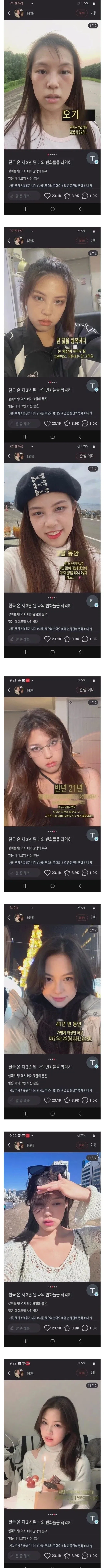 중국에서 한국 유학 온지 3년된 여성의 변화 jpg._1.webp