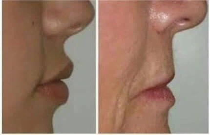 나이 먹을수록 줄어드는 신체 부위_2.webp