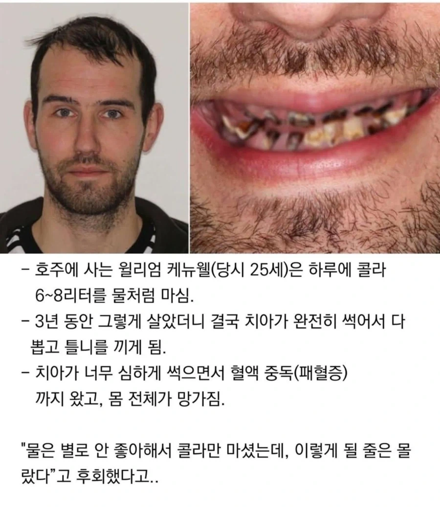 3년간 콜라먹은 남자_1.webp