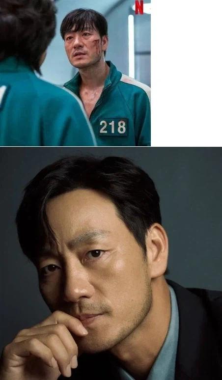 모발 이식 후 초 대박 난 배우_4.webp