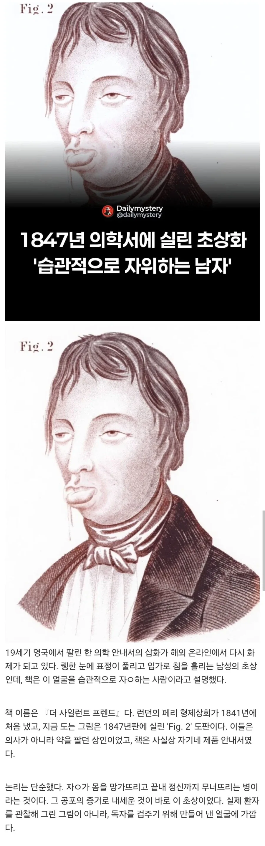 1847년 의학서에 실린, 자위 많이하면 이렇게 되버린다 예 초상화.jpg_1.webp