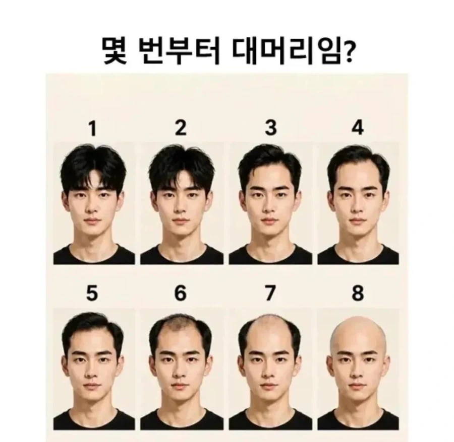 대머리 기준은?_1.webp