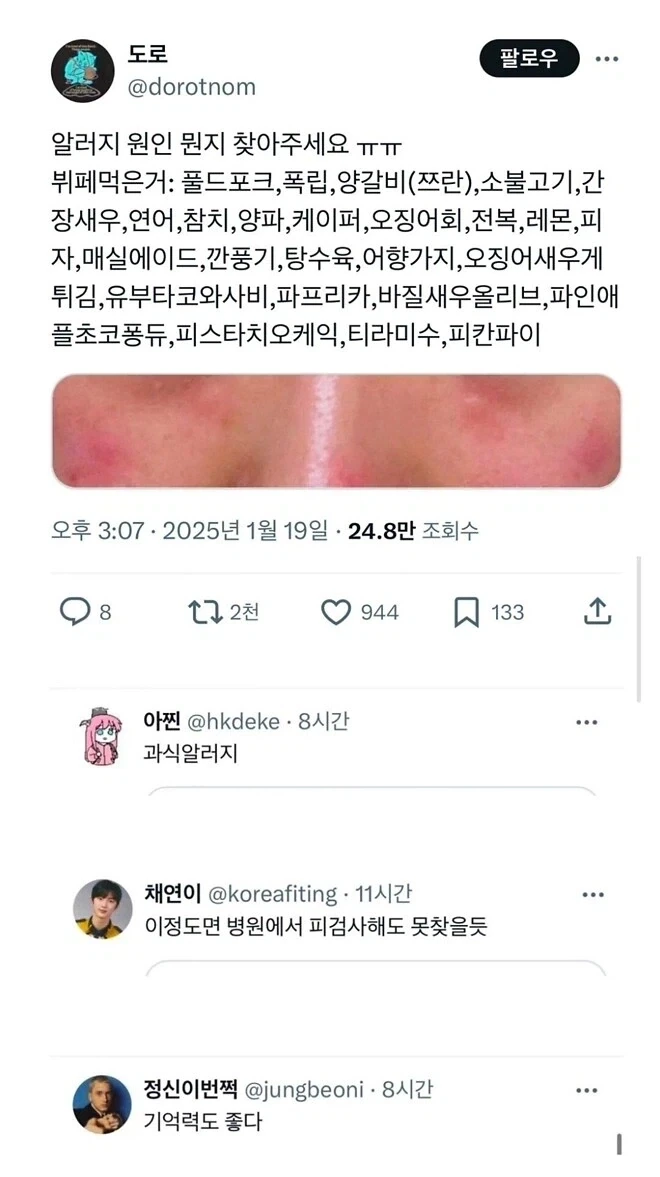 ? : 뷔페 먹고 알러지가 왔는데 뭐가 원인이죠?_1.webp