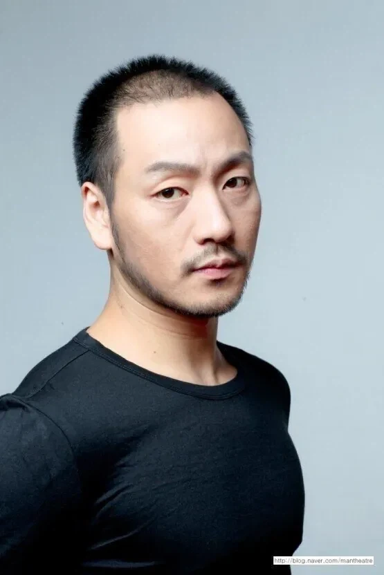 모발이식 후 초대박난 배우.jpg_2.webp