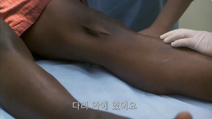 괴생명체를 제거하려면 다리를 절단해야 해요.jpg_1.jpg