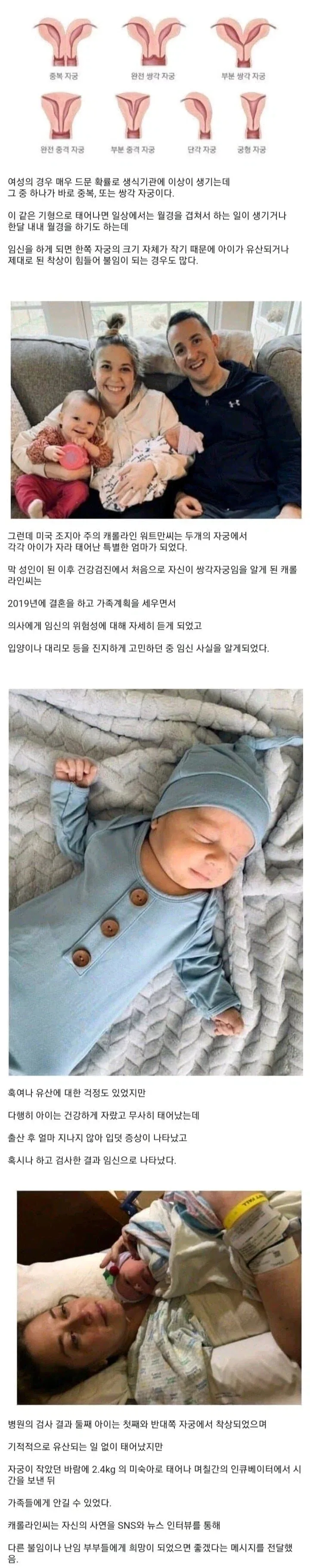 임신을 동시에 2번한 여성_1.webp