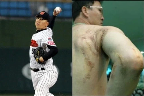 KBO] 팀의 우승과 맞바꾼 선수의 어깨..._1.webp