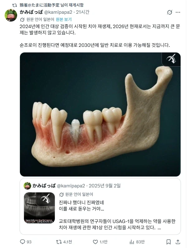 치아가 재생하는 약이 연구중이라고함_1.webp