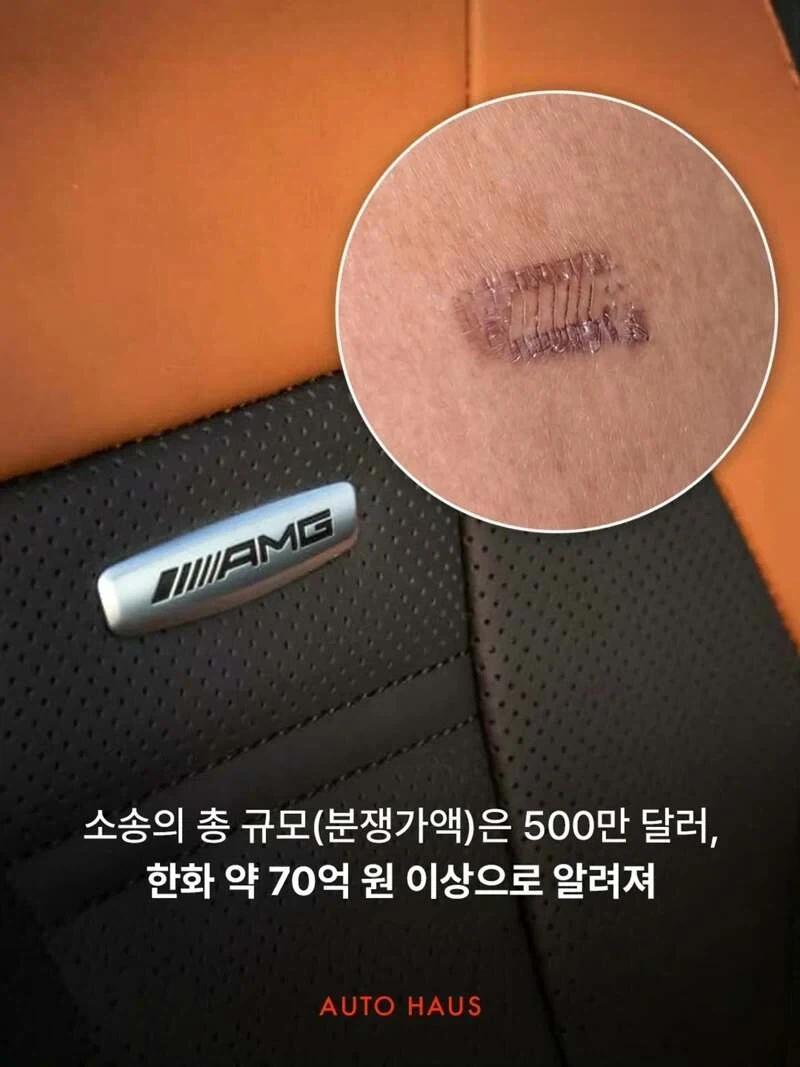70억 소송 걸린 벤츠_6.webp