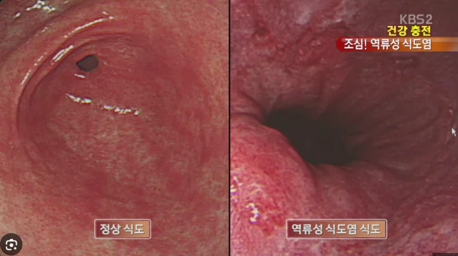 의외로 장애 질병_1.webp