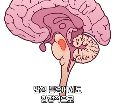 만성 통증 VS 공포·갈증·배고픔.jpg_12.webp