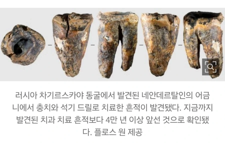 고대인류 갱신 정보. 5만년전에도 치과 치료 했을지도?_1.webp