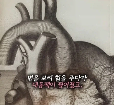 똥 싸다 죽은 왕.jpg_11.webp