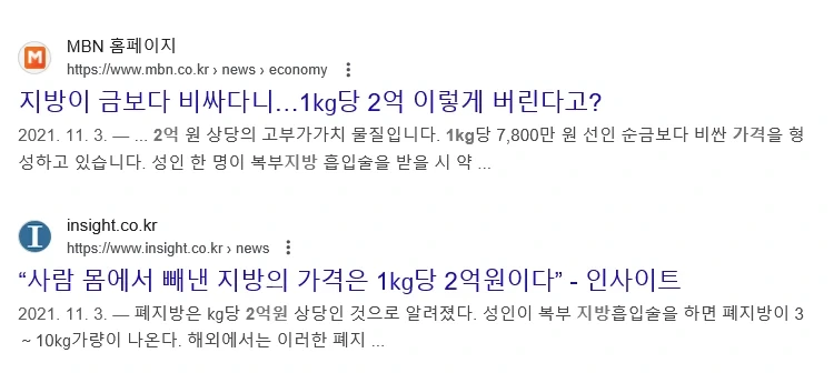의외로 비싼 신체 부위_1.webp