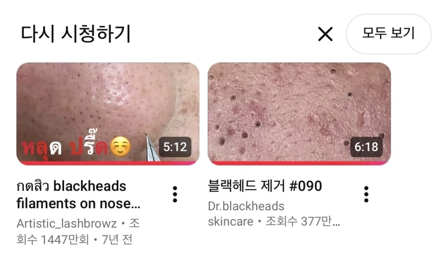 징그럽지만 보게 되는 영상_1.webp