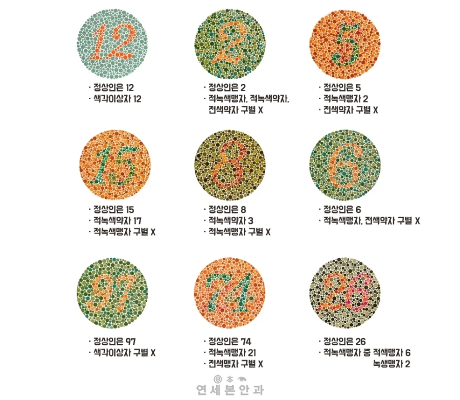 색맹·색약 검사_1.webp