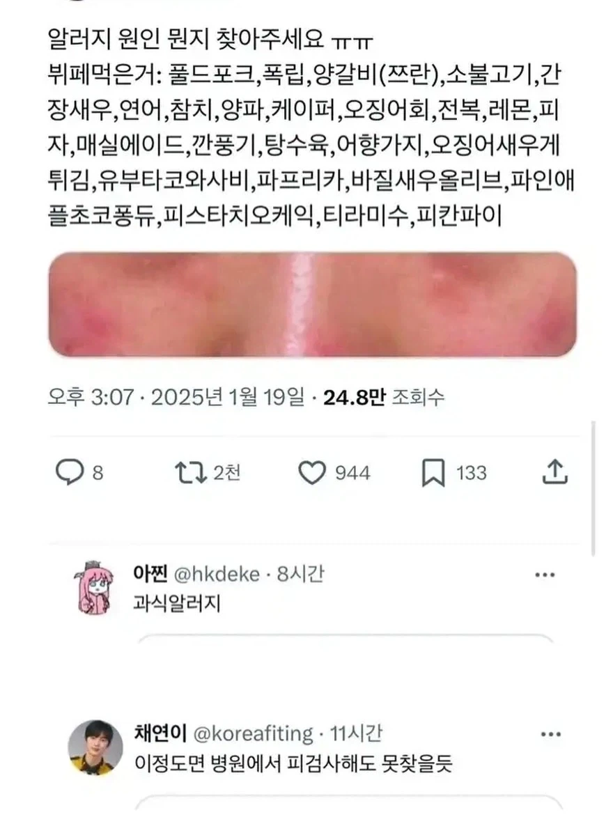 알러지 원인 좀 찾아주세요 ㅠㅠ_1.webp
