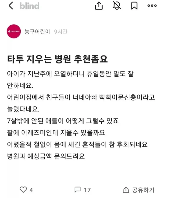 문신한 남자가 문신을 지우는 시기_2.webp