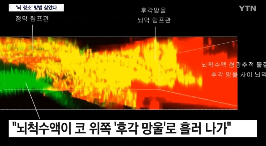 뇌) 뇌의 하수구 구멍이 코였다는데?_2.webp