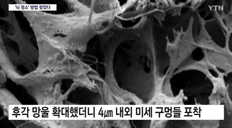 뇌) 뇌의 하수구 구멍이 코였다는데?_3.webp