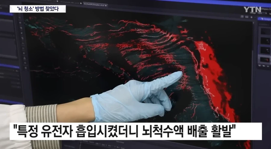 뇌) 뇌의 하수구 구멍이 코였다는데?_8.webp