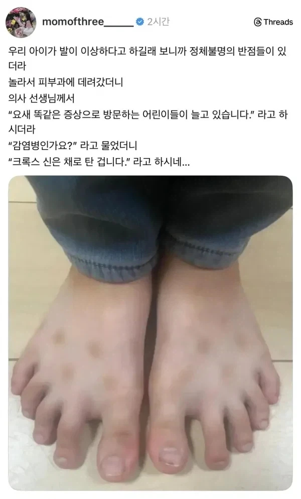 여름이면 유행한다는 피부병_1.webp
