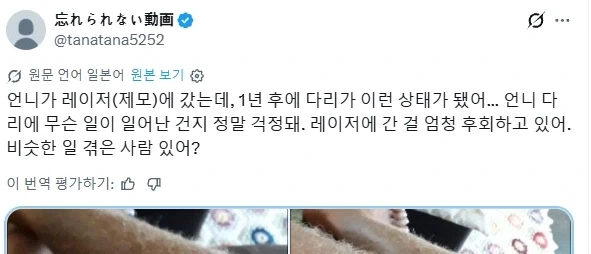 레이저 제모를 한 어느 여성에게 일어난 부작용;;_1.webp