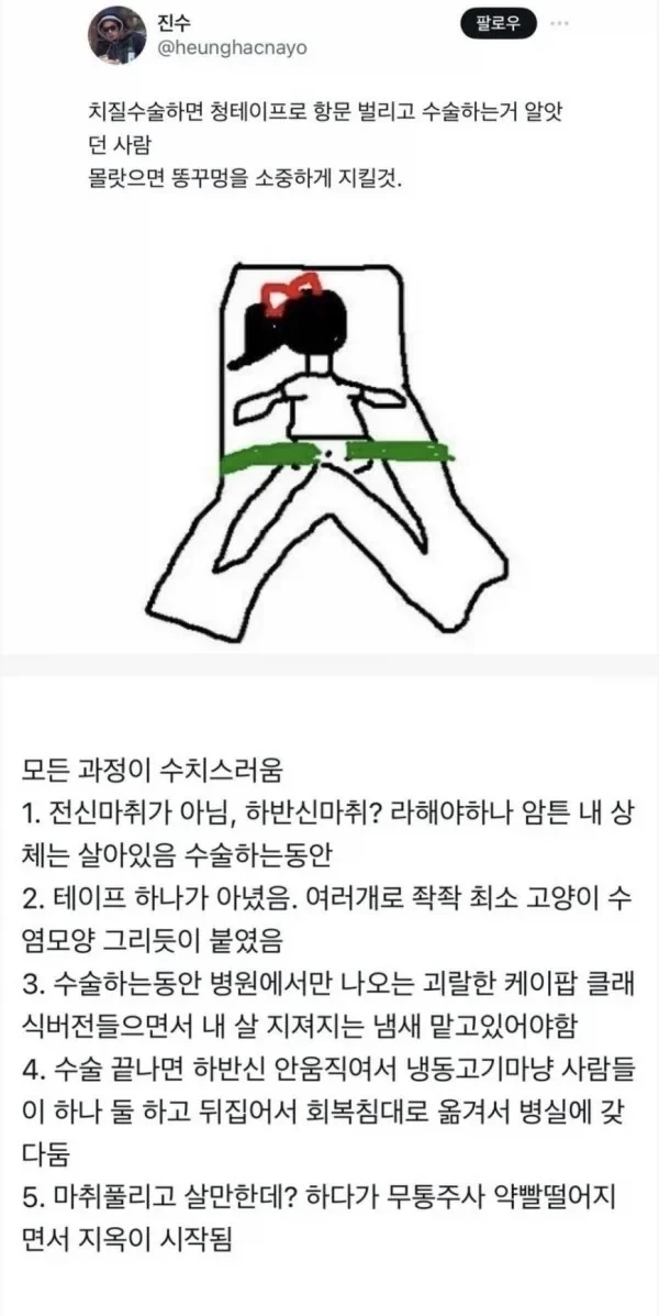 똥구멍을 소중하게 지켜야 하는 이유_1.webp