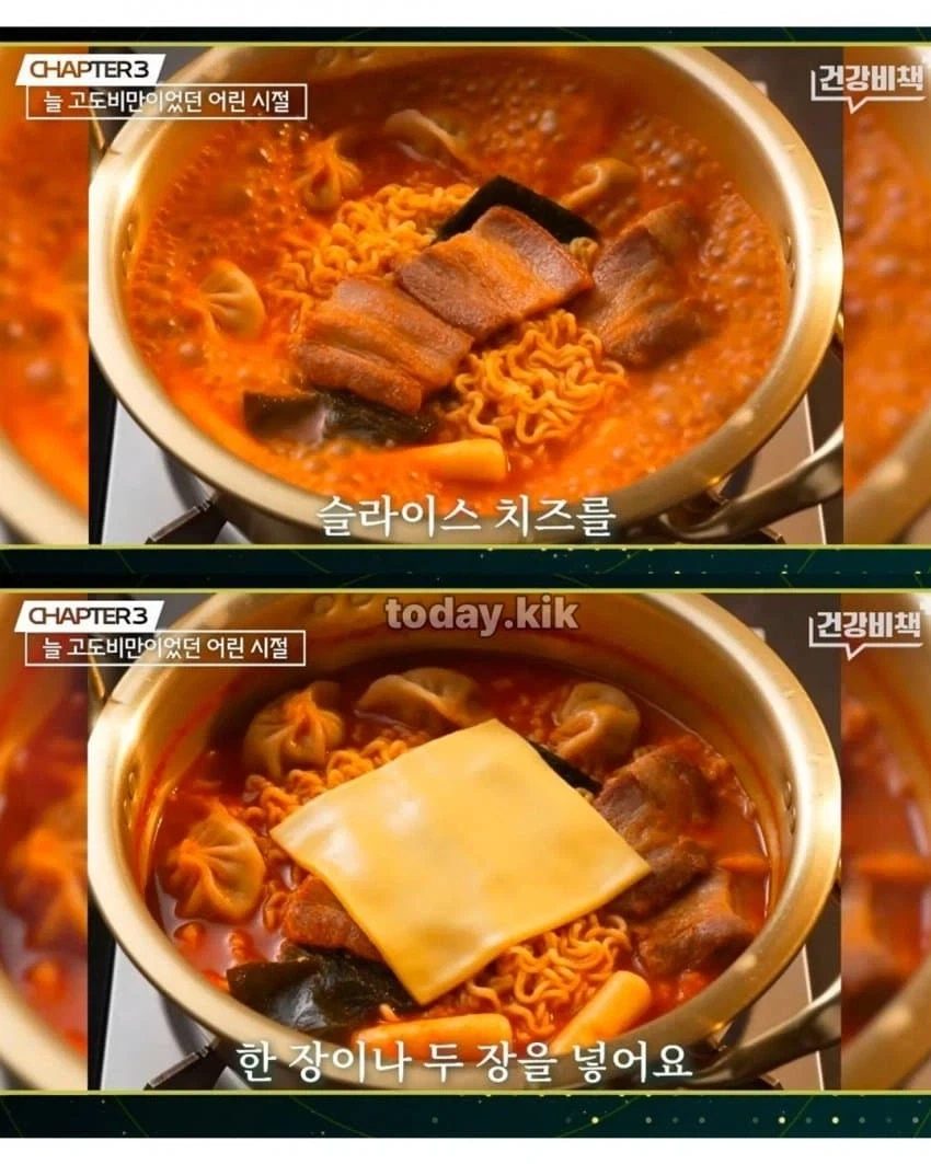 아구창 교수가 고등학생 시절 먹었다는 라면.jpg_8.webp