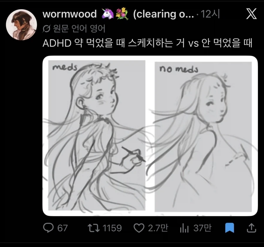 adhd약 먹었을 때랑 안 먹었을때_1.webp