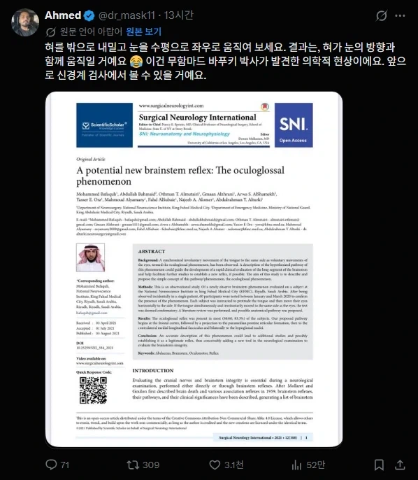 혀를 내밀고, 눈을 감은뒤, 눈을 좌우로 움직여보셈_1.webp