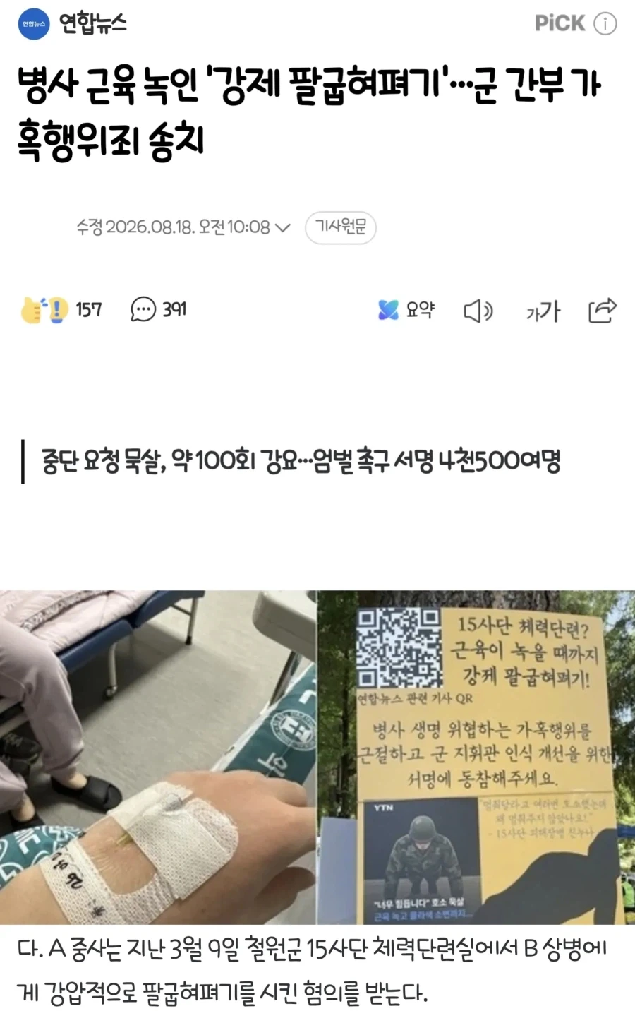 병사 근육 녹인