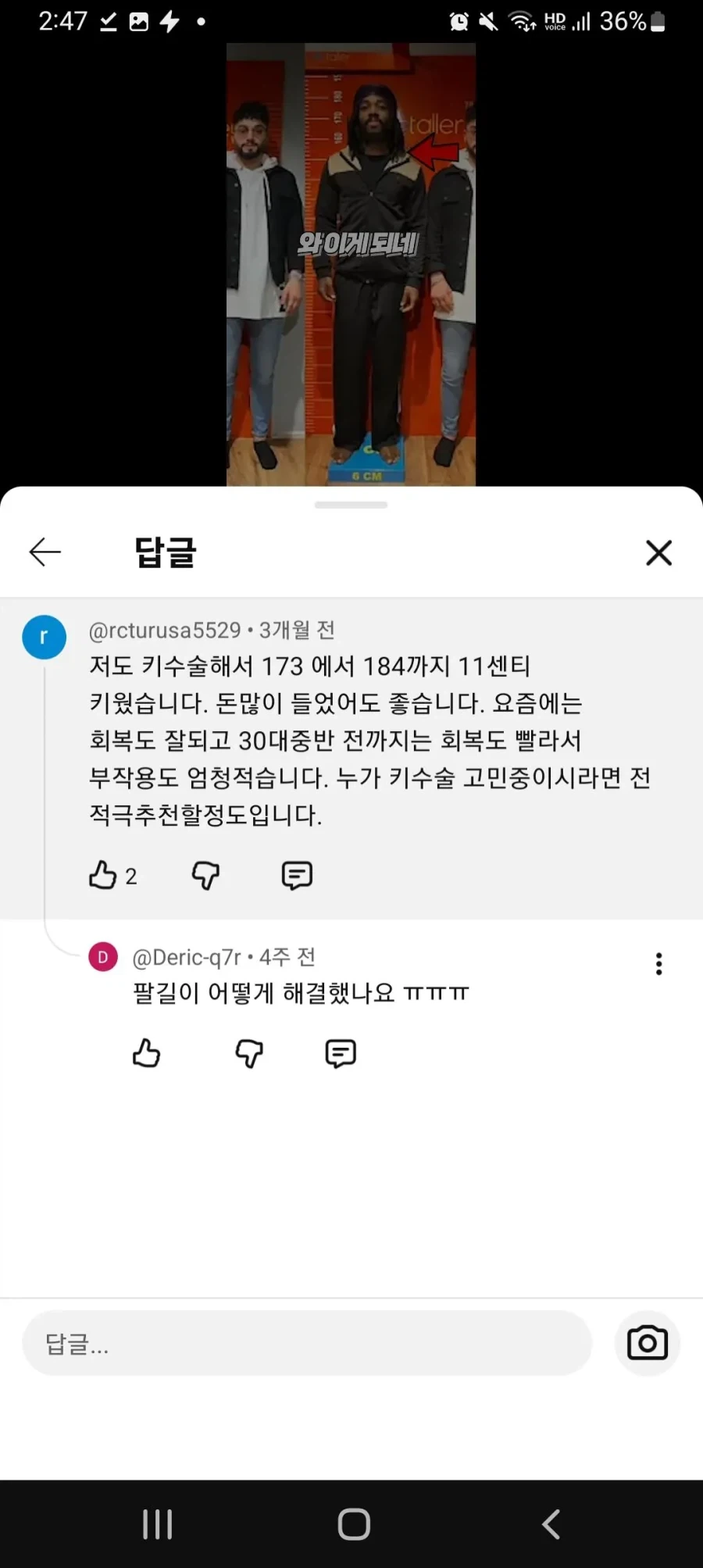 다큐에 나온 키수술 부작용_2.webp