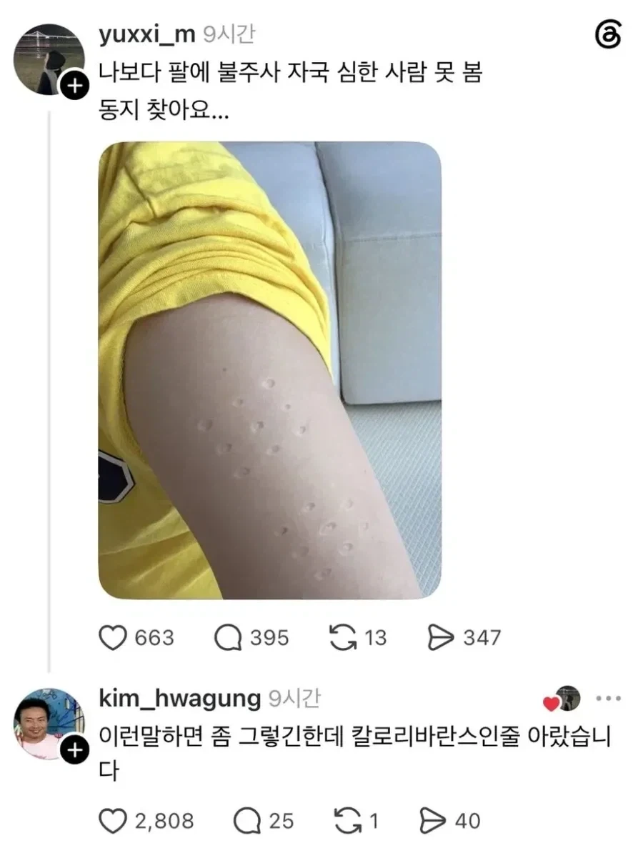 불주사 자국 레전드.JPG_1.webp